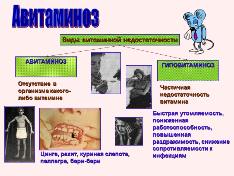 Авитаминоз Виды витаминной недостаточности АВИТАМИНОЗ  ГИПОВИТАМИНОЗ  Отсутствие в организме какого-либо витамина Цинга,